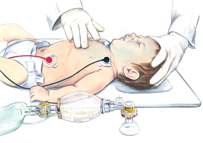 2-finger compressions on infant illustration