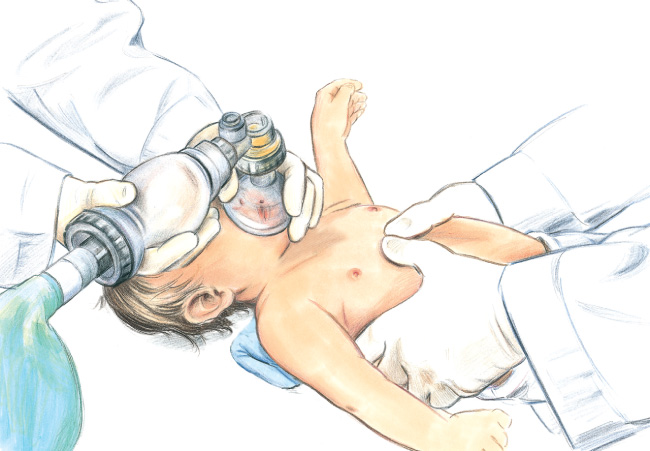 2-thumb encircling hands compressions on infant illustration