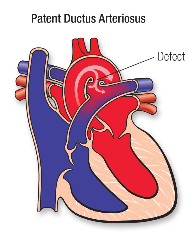 PDA diagram