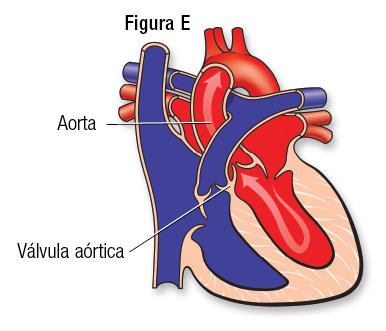 Normal Fig E SP