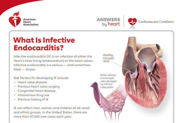 heart-valves-and-infective-endocarditis-american-heart-association