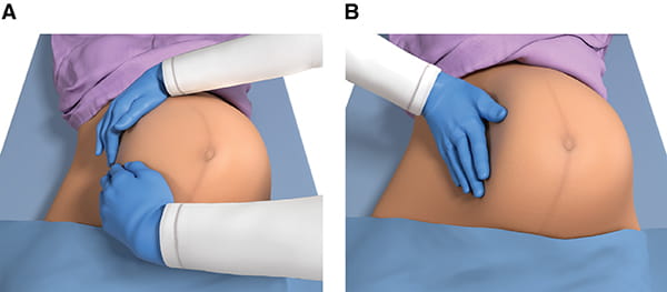 Figure 6. Manual left lateral uterine displacement