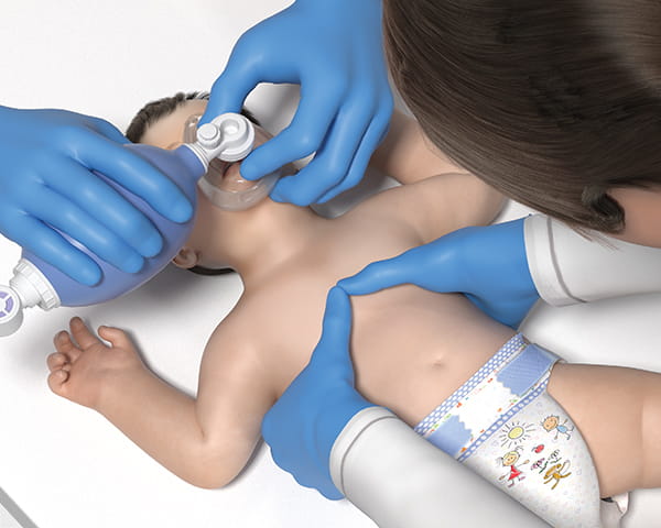 Figure 12 – 2 Thumb-encircling hands technique