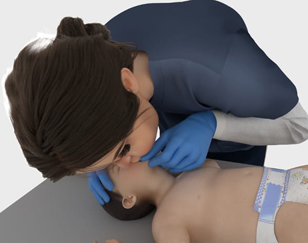 6.1.1. Figure 2 – Head tilt-chin maneuver in infants