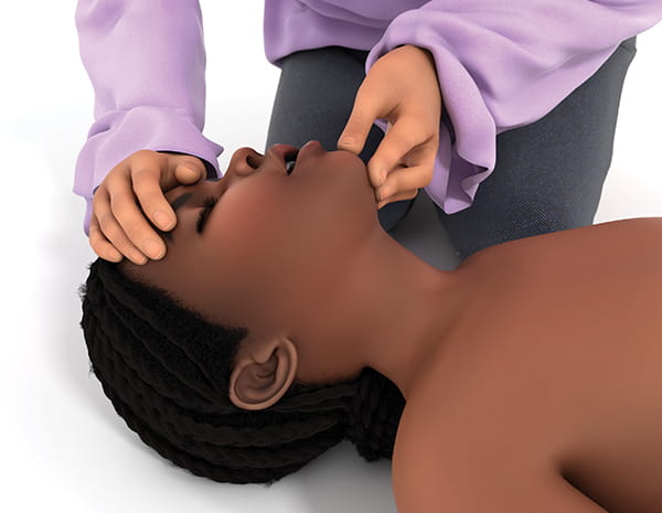 Figure 4. Opening the airway using the head tilt chin lift technique