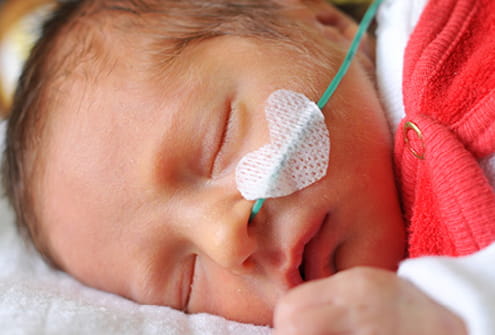 NICU Baby image NICU Baby image