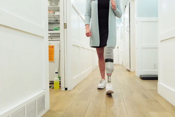Woman walking with prosthetic leg